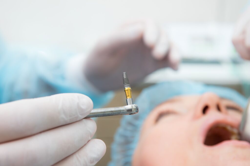 Dentist holding implant for surgery with patient blurry in background